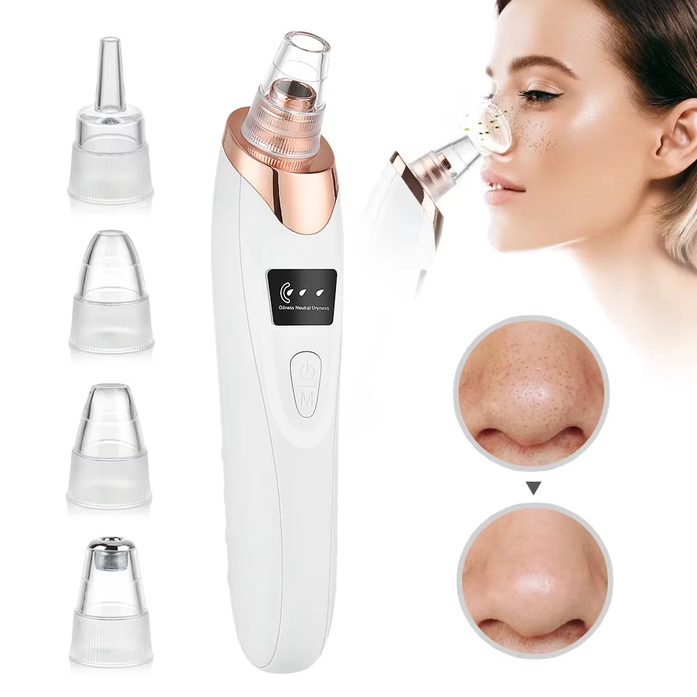 Revitalize Your Skin with Our Powerful Blackhead Remover Vacuum - Electric Face Cleaning Tool for Acne & Pore Perfection